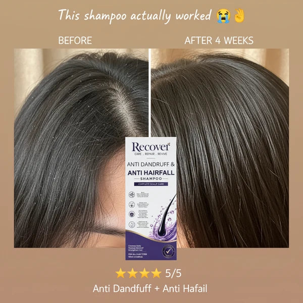 Recover Anti Dandruff & Anti Hairfall Shampoo – Complete Scalp Care